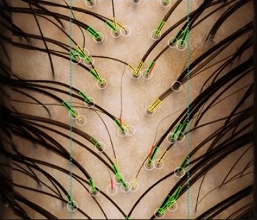 Magnified scalp analysis capture